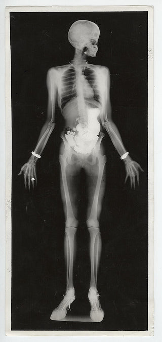 [X-Ray] Transparent Lady (Eastman Kodak x-ray research lab), 1934. 4.5" x 10". Gelatin silver print